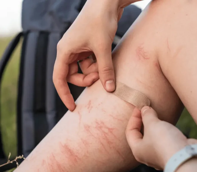 How to Hide Scars on Legs When Swimming